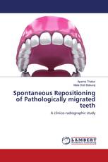 Spontaneous Repositioning of Pathologically migrated teeth