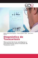 Diagnóstico de Toxocariosis