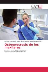 Osteonecrosis de los maxilares
