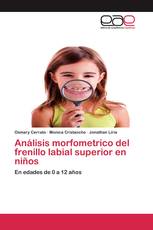 Análisis morfometrico del frenillo labial superior en niños