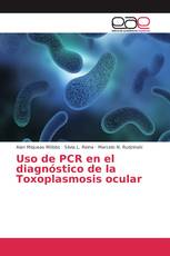 Uso de PCR en el diagnóstico de la Toxoplasmosis ocular