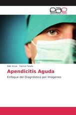 Apendicitis Aguda