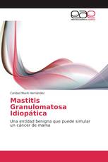 Mastitis Granulomatosa Idiopática
