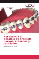 Resistencia al desalojo de brackets nuevos, arenados y reciclados