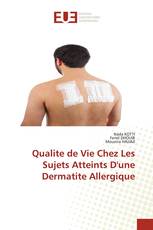 Qualite de Vie Chez Les Sujets Atteints D'une Dermatite Allergique