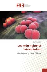 Les méningiomes intracrâniens