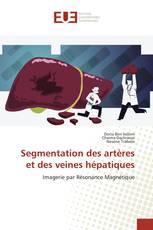 Segmentation des artères et des veines hépatiques