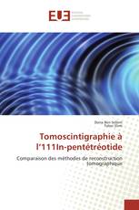 Tomoscintigraphie à l’111In-pentétréotide