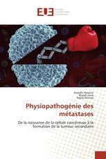 Physiopathogénie des métastases