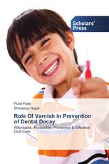 Role Of Varnish in Prevention of Dental Decay