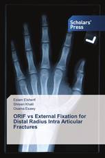 ORIF vs External Fixation for Distal Radius Intra Articular Fractures