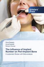 The Influence of Implant Number on Peri-Implant Bone