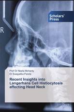 Recent Insights into Langerhans Cell Histiocytosis affecting Head Neck