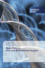 Stem Cells in Oral and Maxillofacial Surgery