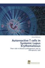 Autoreactive T cells in Systemic Lupus Erythematosus