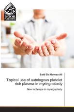 Topical use of autologous platelet rich plasma in myringoplasty