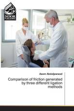 Comparison of friction generated by three different ligation methods