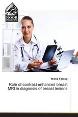 Role of contrast enhanced breast MRI in diagnosis of breast lesions