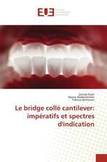 Le bridge collé cantilever: impératifs et spectres d'indication