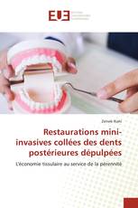 Restaurations mini-invasives collées des dents postérieures dépulpées