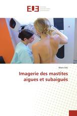 Imagerie des mastites aigues et subaiguës