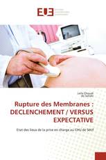 Rupture des Membranes : DECLENCHEMENT / VERSUS EXPECTATIVE