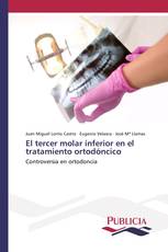 El tercer molar inferior en el tratamiento ortodóncico