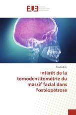 Intérêt de la tomodensitométrie du massif facial dans l’ostéopétrose