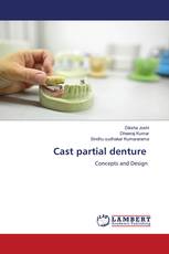 Cast partial denture