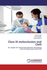Class III malocclusion and Cleft