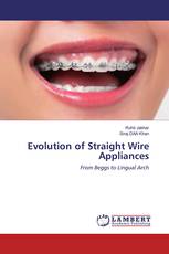 Evolution of Straight Wire Appliances