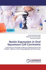 Nestin Expression in Oral Squamous Cell Carcinoma
