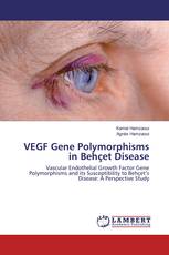 VEGF Gene Polymorphisms in Behçet Disease