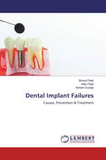 Dental Implant Failures