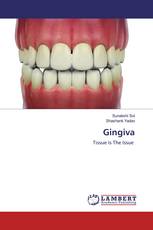 Gingiva