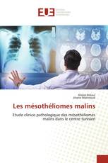 Les mésothéliomes malins