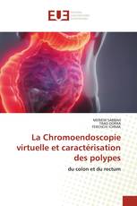 La Chromoendoscopie virtuelle et caractérisation des polypes