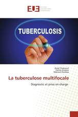La tuberculose multifocale