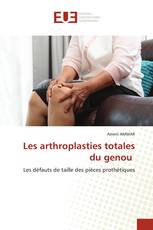 Les arthroplasties totales du genou