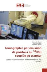 Tomographie par émission de positons au 18FDG couplée au scanner