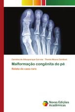 Malformação congênita do pé