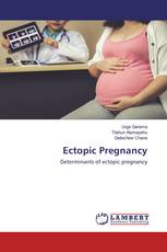 Ectopic Pregnancy