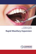 Rapid Maxillary Expansion