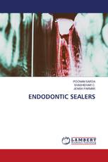 ENDODONTIC SEALERS