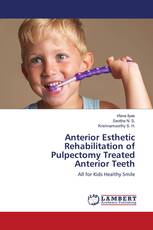 Anterior Esthetic Rehabilitation of Pulpectomy Treated Anterior Teeth