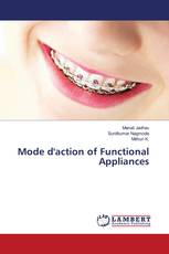 Mode d'action of Functional Appliances