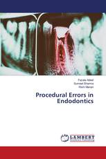 Procedural Errors in Endodontics