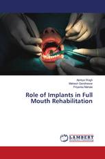 Role of Implants in Full Mouth Rehabilitation