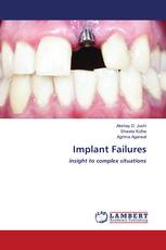 Implant Failures