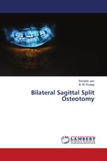 Bilateral Sagittal Split Osteotomy